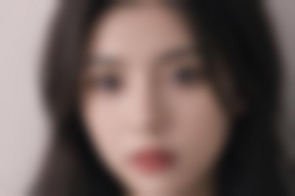 {缩鼻翼手术真的能改善大鼻子吗？医生为你解答