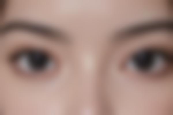 超脉冲激光真的能吗？10年医美编辑