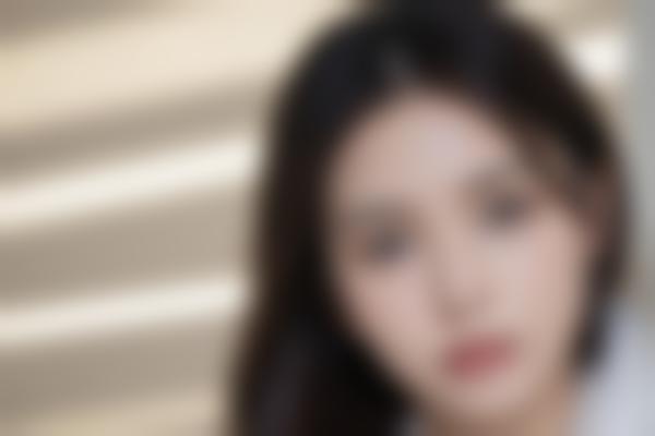 冰点脱毛多少钱？2024年新价格表+真实大